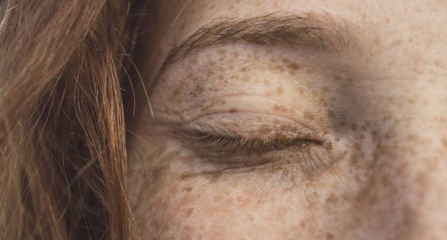 Eye Doctor Treatment Eyelid Pain Stye 650×350